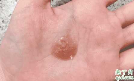 天露芬沙棘双效精华孕妇可以用吗?适合油皮吗 天露芬沙棘双效精华孕妇可以用吗?适合油皮吗