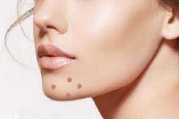 下巴两侧上长痘痘是什么原因