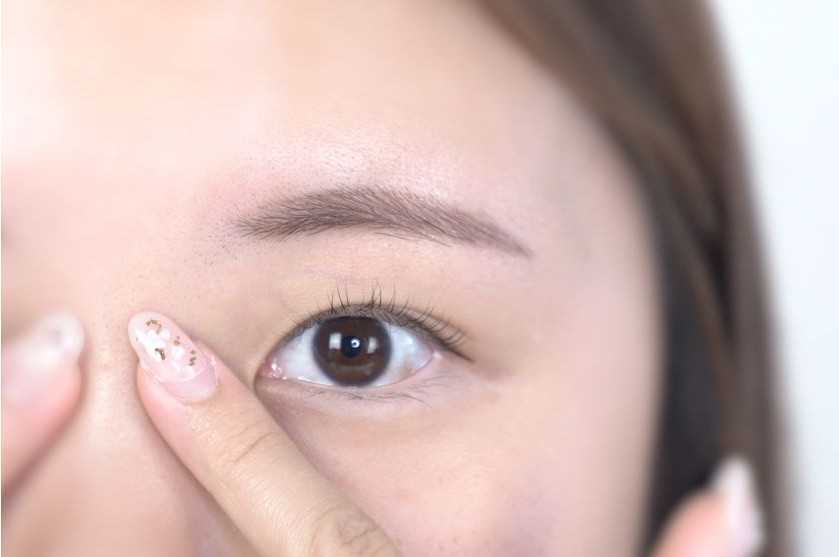 如何快速消除眼部浮肿