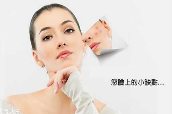 痘痘肌用什么水乳好