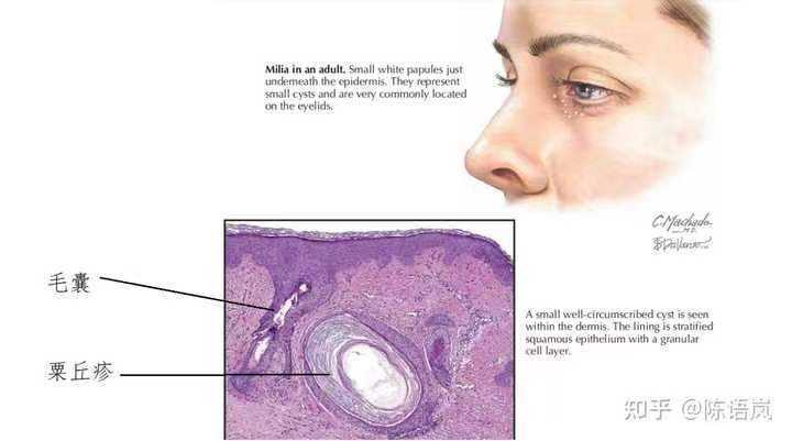 眼霜真的有用吗？