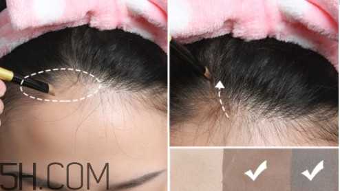 发际线不好看怎么修饰 完美解决6种发际线问题