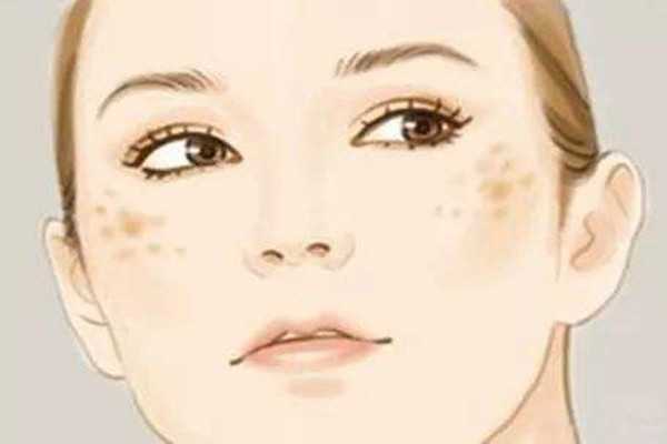 晒斑是什么样子的 晒斑是什么样子的