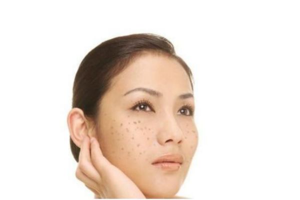 斑的种类有什么？斑是怎么形成的