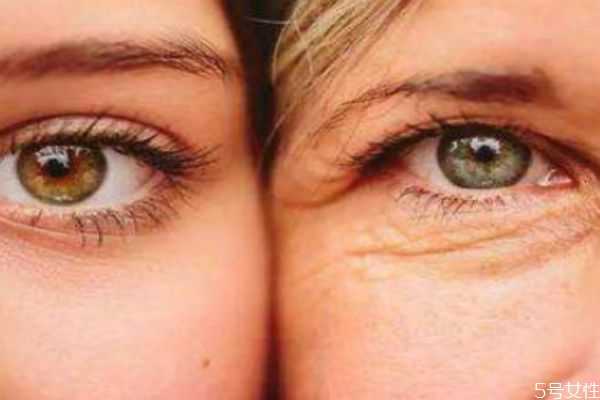 维生素e加凡士林可以去眼纹吗?维生素e加凡士林要洗吗