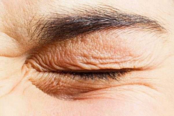 眼部细纹可以热敷吗