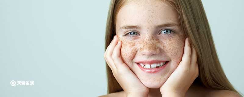 晒斑和雀斑的区别 晒斑和雀斑的区别