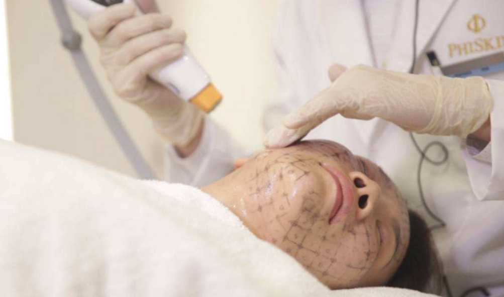 热玛吉五代做一次效果能维持多久？热玛吉五代做完需要注意什么