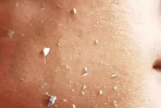 防晒霜擦了起泥是怎么回事插图