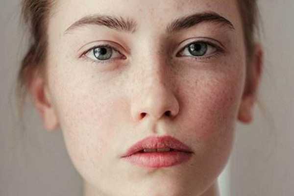 脸上长斑是什么原因？