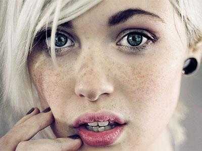 为什么女生会长麻子?女生长麻子的原因是什么 为什么女生会长麻子?女生长麻子的原因是什么