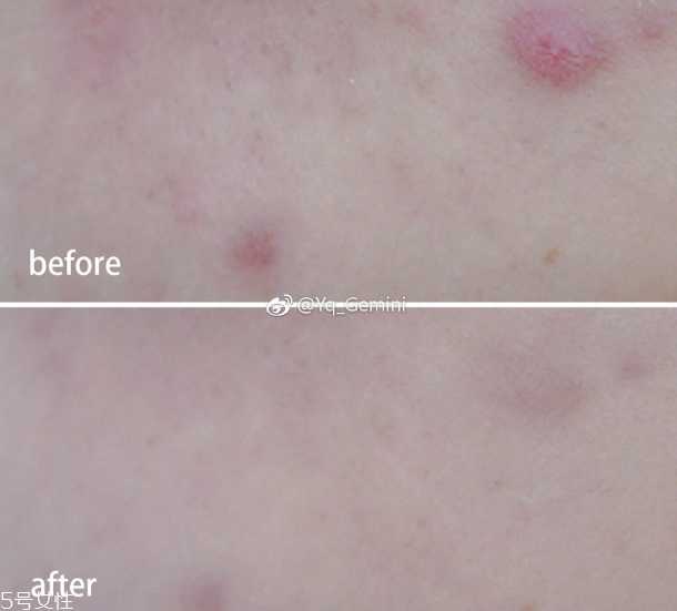 悦诗风吟小白管怎么用 悦诗风吟小白管怎么用