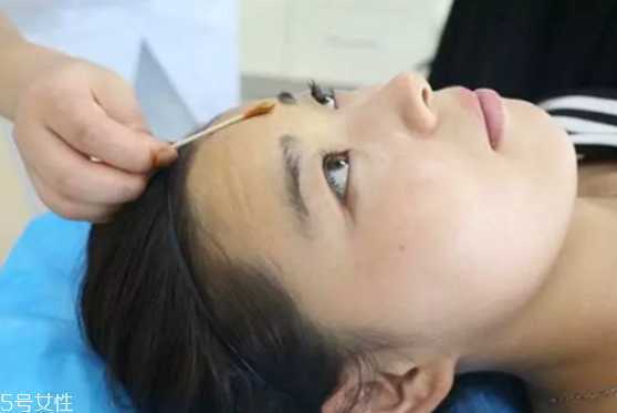 有抬头纹怎么办？如何去除抬头纹