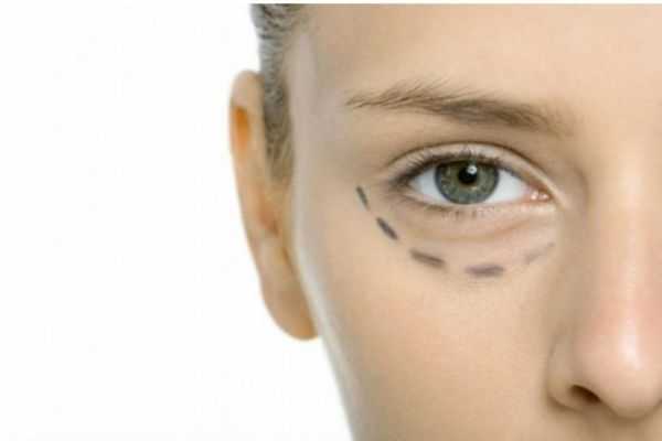 怎样去眼袋和黑眼圈