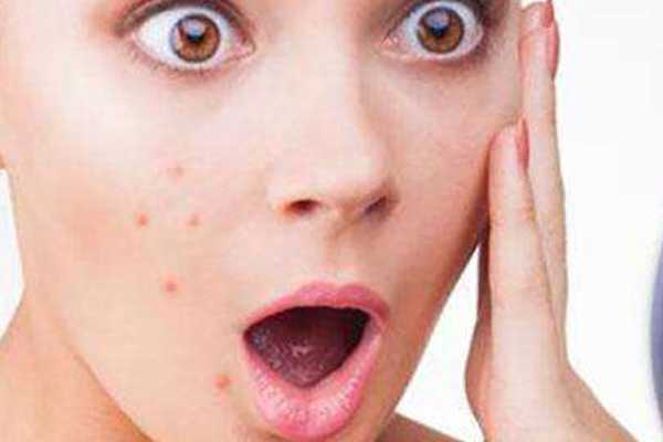 痘肌油皮适合用的防晒 痘肌油皮适合用的防晒