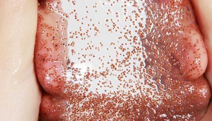 海藻颗粒面膜的坏处 海藻颗粒面膜的坏处