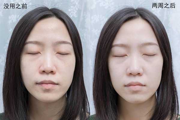 lg美容面罩有用么