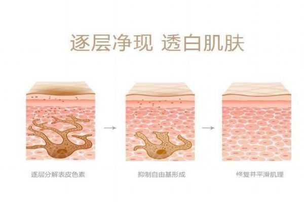 彩光嫩肤的工作原理是什么呢 彩光嫩肤的工作原理是什么呢