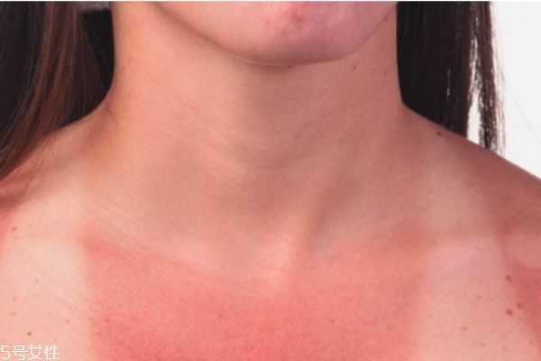 隔离和防晒可以一起用吗