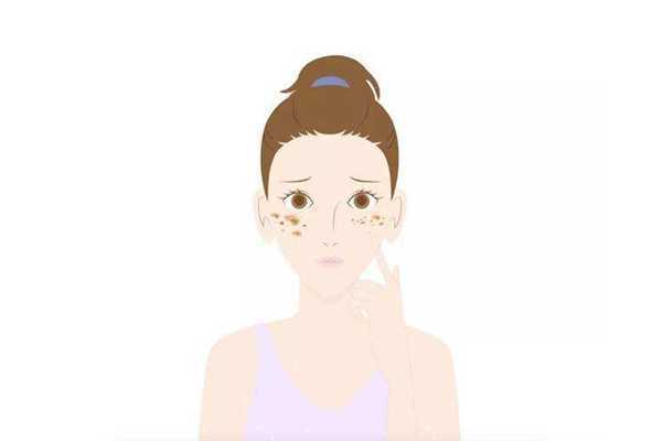 黄褐斑属于真皮斑吗？黄褐斑跟真皮斑的区别