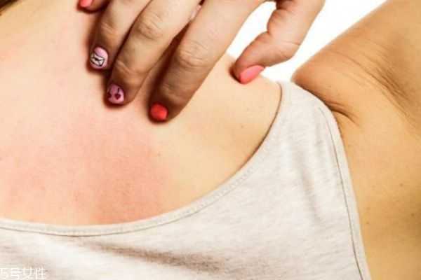 如何消除背部的痘痘