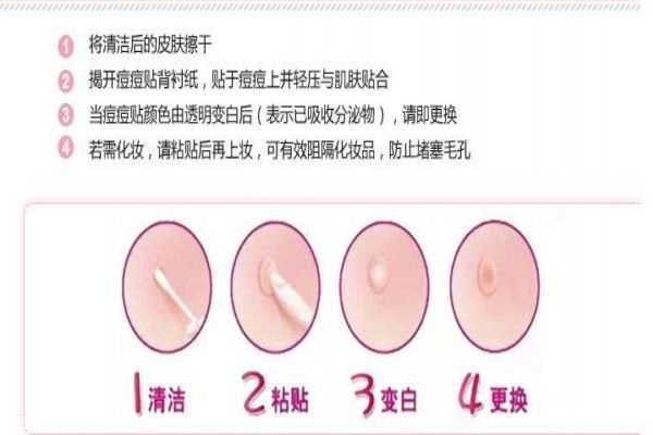 曼秀雷顿痘痘贴怎么样 曼秀雷顿痘痘贴怎么样