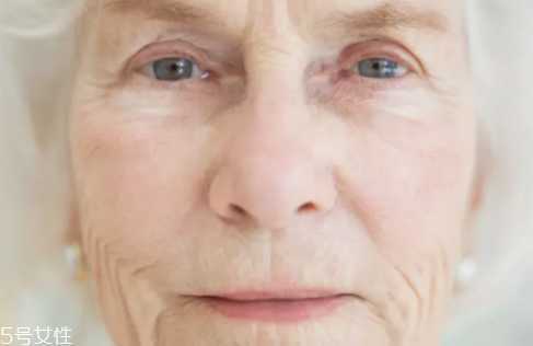 去眼部皱纹最好的方法