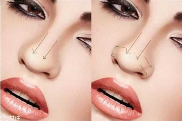 鼻子大鼻翼宽怎么化妆？