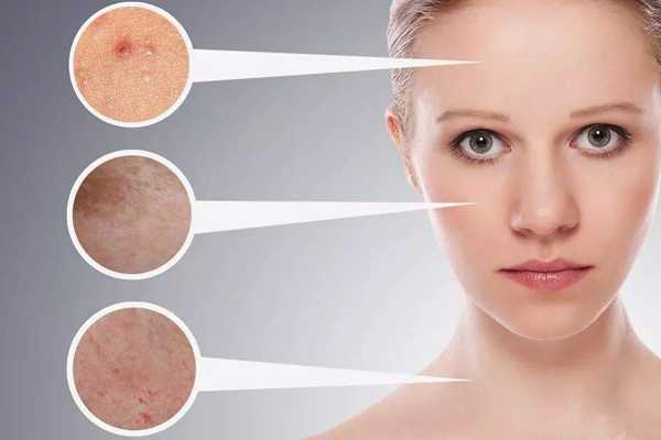 泰国小海藻面膜的功效 泰国小海藻面膜的功效