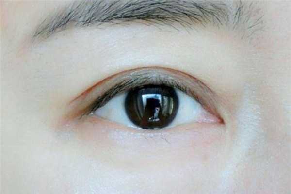 长期贴双眼皮贴有什么危害?双眼皮贴有几种类型 长期贴双眼皮贴有什么危害?双眼皮贴有几种类型