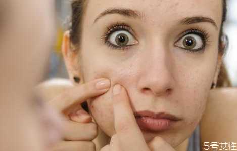 戴口罩会长痘痘吗？长期戴口罩脸上长痘痘怎么办