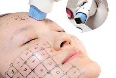 热玛吉可以去除双下巴吗?热玛吉能瘦脸吗 热玛吉可以去除双下巴吗?热玛吉能瘦脸吗