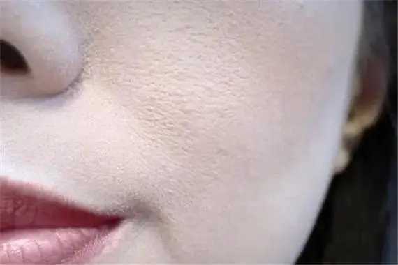 脸上卡粉是什么原因?怎么解决 脸上卡粉是什么原因?怎么解决