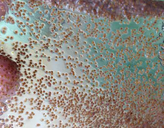 海藻面膜能去黑头吗？海藻面膜有去黑头功效吗？