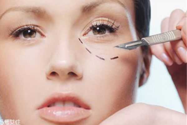 怎么样祛除眼袋