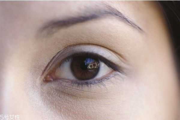 睫毛老是掉怎么办