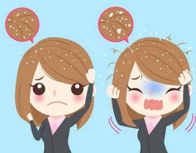 去除头皮屑小妙招 去除头皮屑小妙招