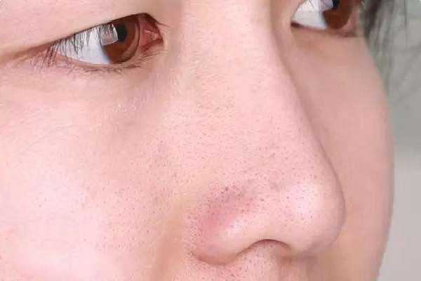 去黑头在面膜前还是后