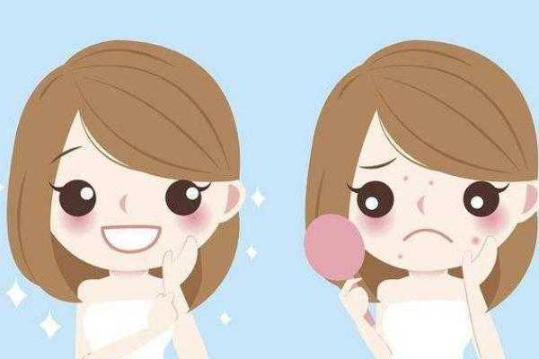 青春痘可以自愈吗？可以用洗面奶吗