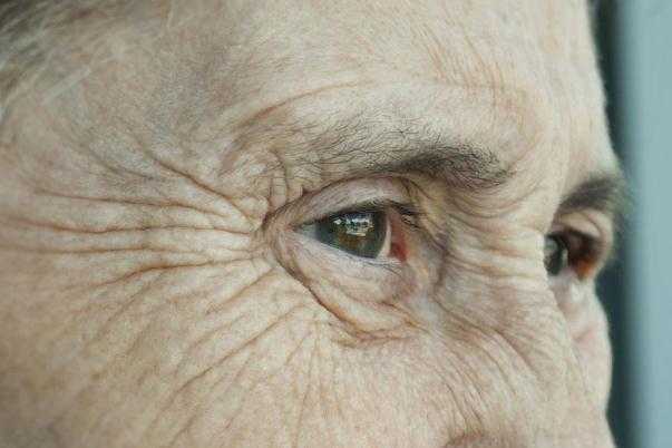 皱纹怎么样才能去掉 皱纹是什么原因造成的 皱纹怎么样才能去掉 皱纹是什么原因造成的