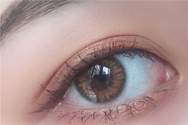 美瞳戴着雾蒙蒙的咋回事