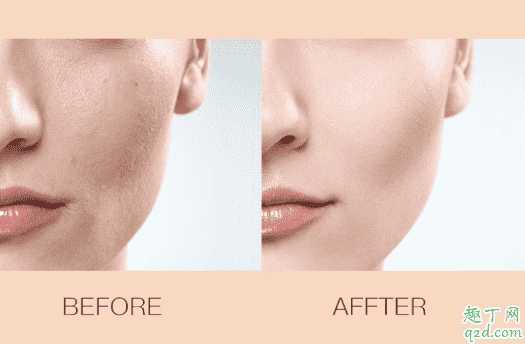 抖音梵贞蘑菇头气垫好用吗?抖音梵贞小蘑菇气垫怎么样