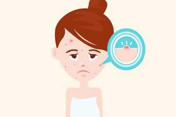 脂肪粒能用甘油去除吗 脂肪粒发痒是怎么回事