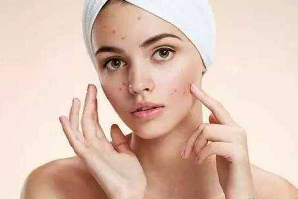 敏感痘痘肌隔离霜排行 敏感痘痘肌隔离霜排行