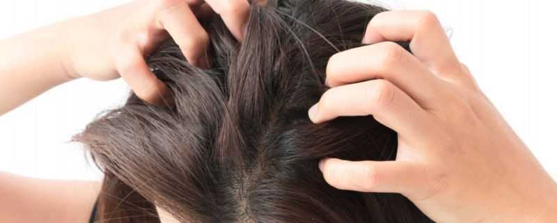 头皮痒怎么办?这个方法可以试一试 头皮痒怎么办?这个方法可以试一试