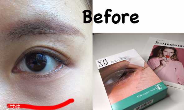 viicode眼膜使用方法