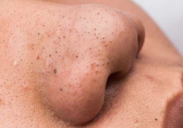 珍珠粉的功效有哪些 珍珠粉的功效有哪些