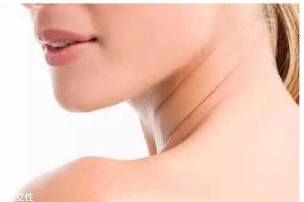 颈纹怎么可以快速消除呢