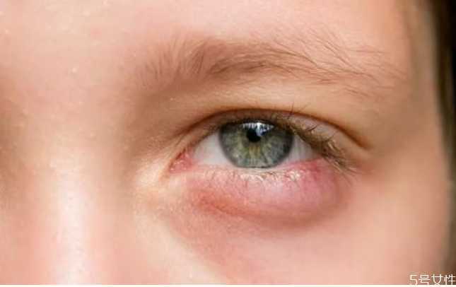 忘记带美瞳盒怎么办？没带护理液可以用什么代替