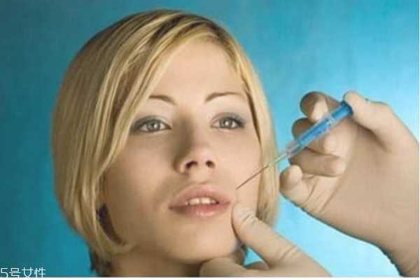 法令纹怎么形成的 消除法令纹最好的方法